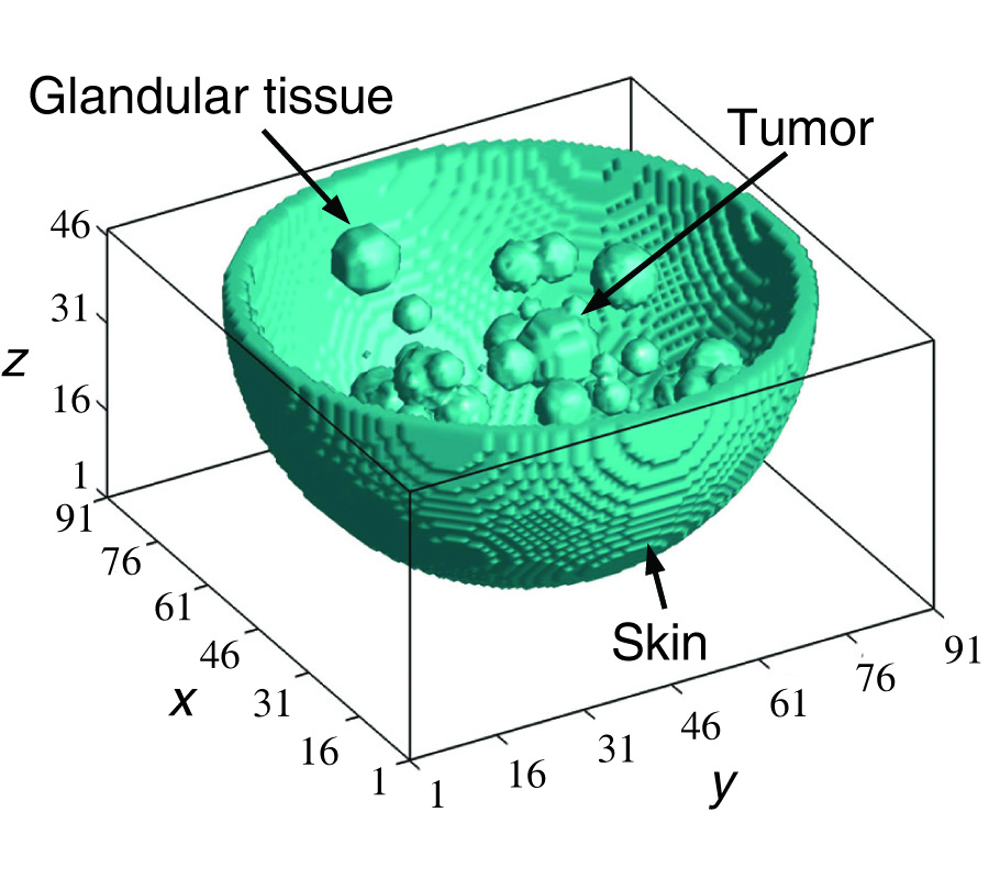 A BREAST IMAGING MODEL USING MICROWAVES AND A TIME DOMAIN THREE DIMENSIONAL RECONSTRUCTION METHOD