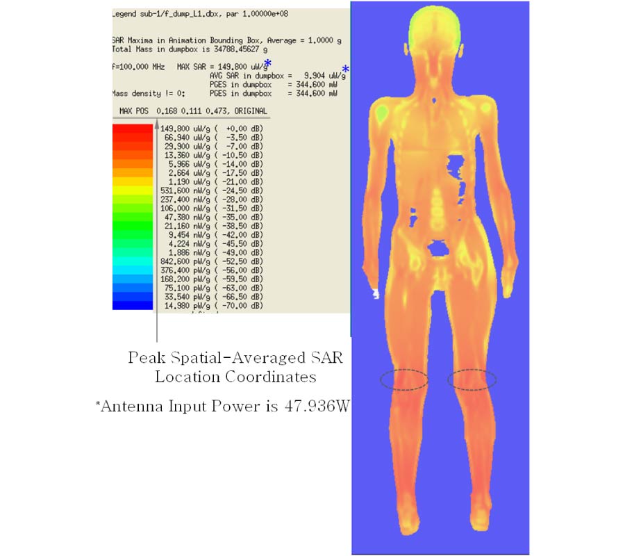 CALCULATION OF WHOLE-BODY SAR FROM A 100 MHZ DIPOLE ANTENNA