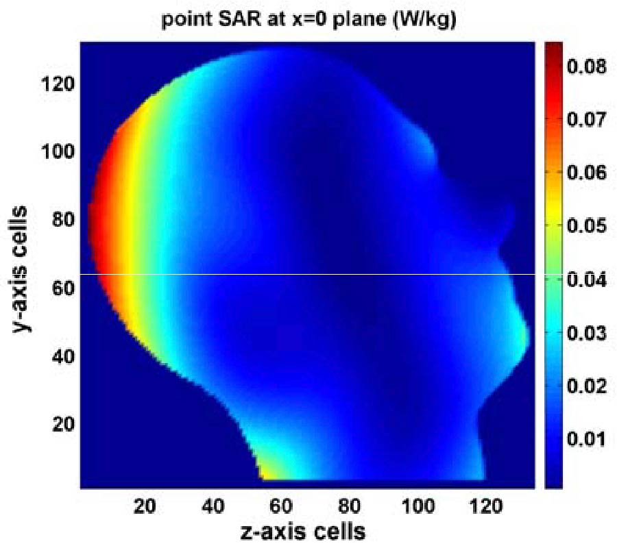 A NOVEL DIELECTRIC CONFORMAL FDTD METHOD FOR COMPUTING SAR DISTRIBUTION OF THE HUMAN BODY IN A METALLIC CABIN ILLUMINATED BY AN INTENTIONAL ELECTROMAGNETIC PULSE (IEMP)