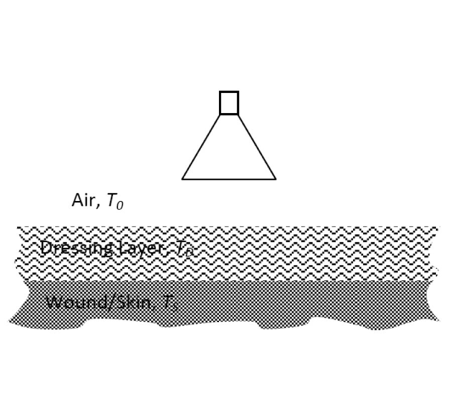 ON THE FEASIBILITY OF ASSESSING BURN WOUND HEALING WITHOUT REMOVAL OF DRESSINGS USING RADIOMETRIC MILLIMETRE-WAVE SENSING