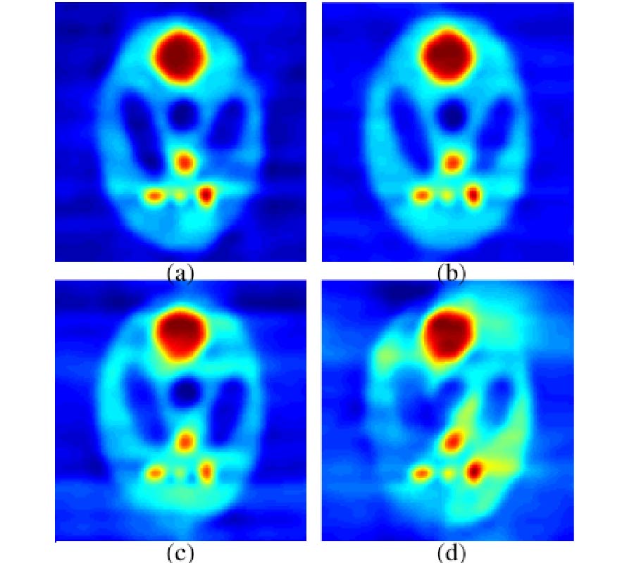 IMAGE RECONSTRUCTION FROM HIGHLY SPARSE AND LIMITED ANGULAR DIFFRACTION TOMOGRAPHY USING COMPRESSED SENSING APPROACH