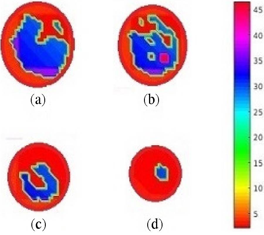 STUDY OF EFFECT OF NUMERICAL BREAST PHANTOM HETEROGENEITY ON DIELECTRIC PROFILE RECONSTRUCTION USING MICROWAVE IMAGING