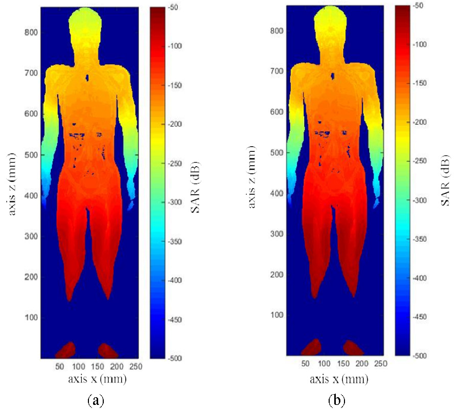 MISALIGNED EFFECT AND EXPOSURE ASSESSMENT FOR WIRELESS POWER TRANSFER SYSTEM USING THE ANATOMICAL WHOLE-BODY HUMAN MODEL