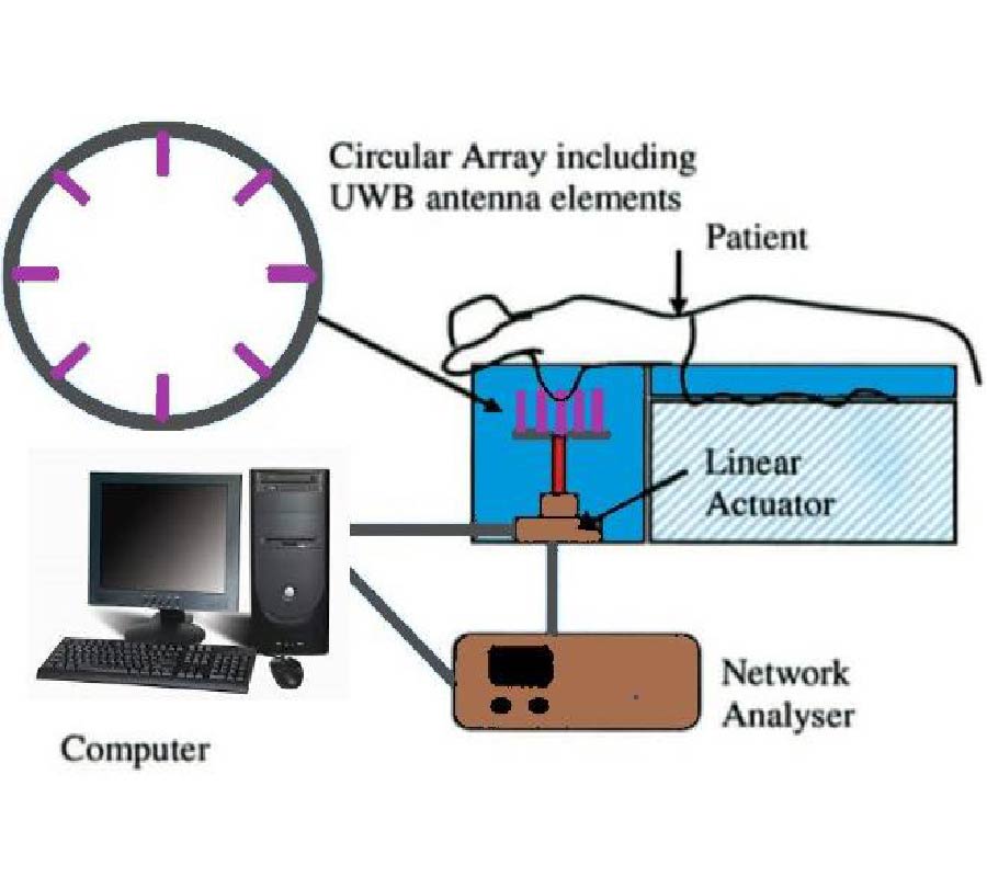 A CIRCULAR SLOTTED SHAPED UWB MONOPOLE ANTENNA FOR BREAST CANCER DETECTION