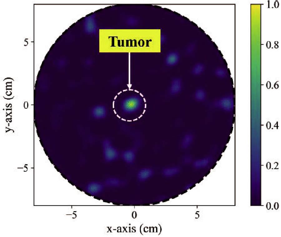 Systematic Performance Evaluation for the Detection of Breast Tumors with Sinusoidal Corrugated Antipodal Vivaldi Antennas Utilizing DAS and It-DAS Methodologies